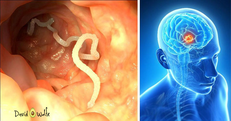 brain worm