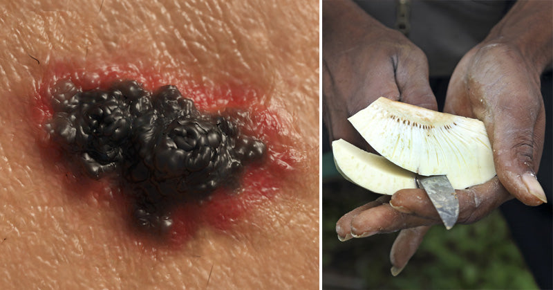 Breadfruit: 5 Health Benefits