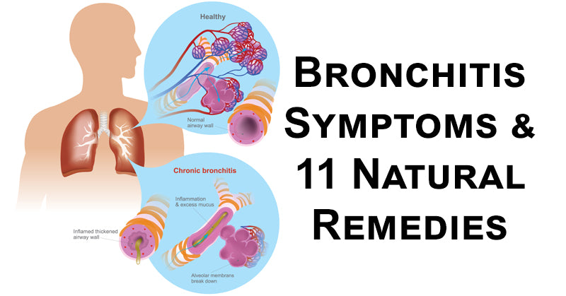 bronchitis FI02