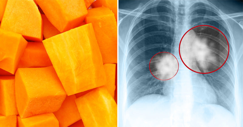 Butternut Squash: 7 Benefits & Uses