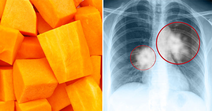 Butternut Squash: 7 Benefits & Uses
