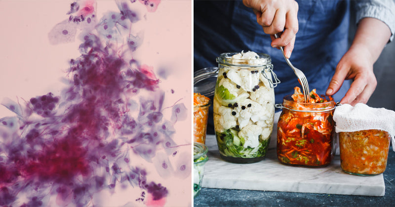candida diet FI