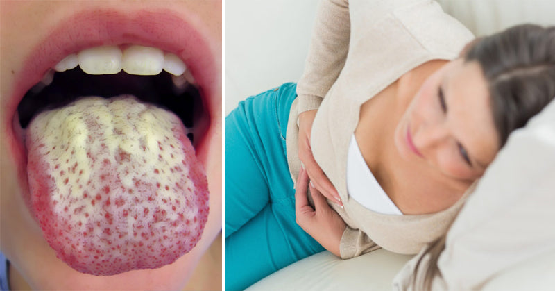 candida symptoms FI