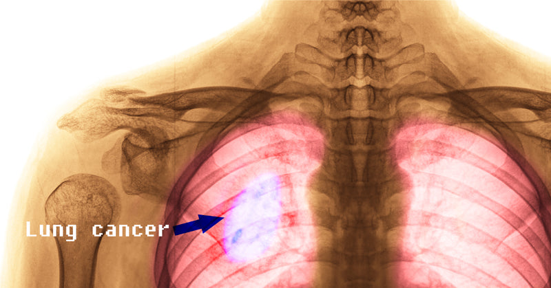 cannabis cancer FI
