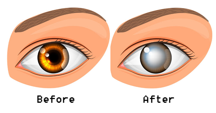 cellphone blindness FI