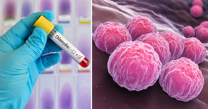 chlamydia symptoms FI