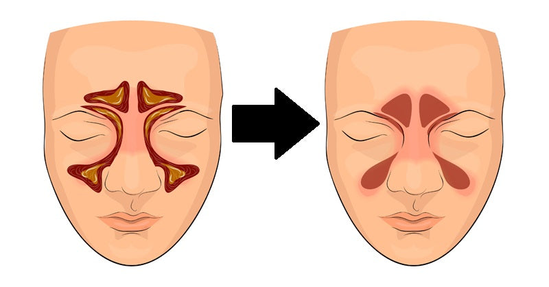 clear sinuses FI
