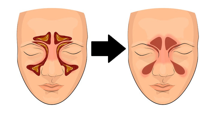 clear sinuses FI