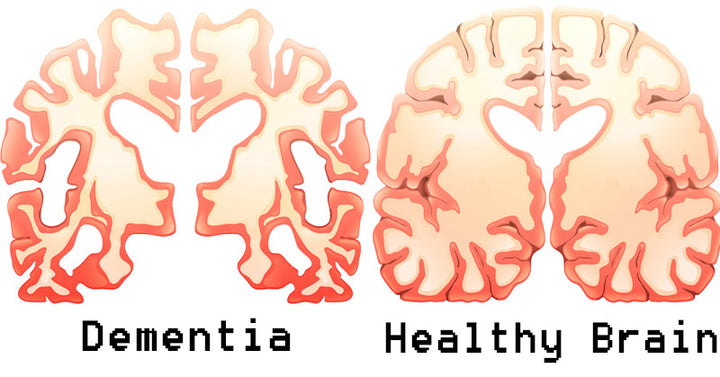 coffee dementia FI