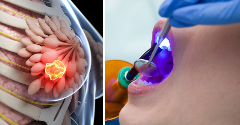 dental work cancer FI