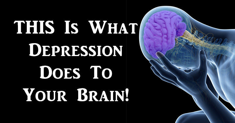 depression brain FI