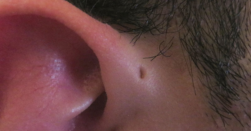 earpit