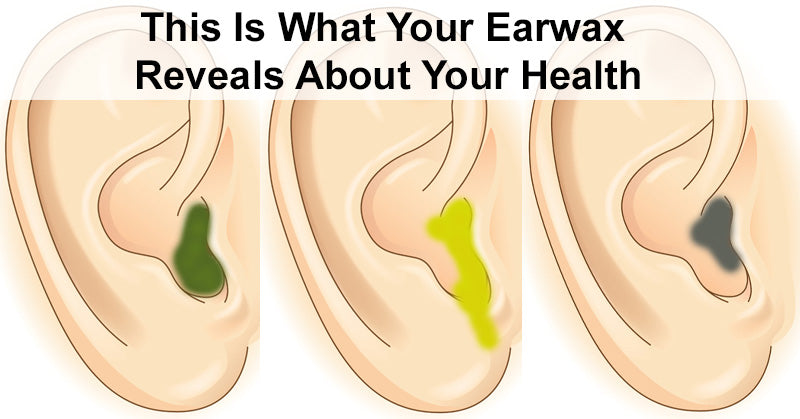 This Is What Your Earwax Reveals About Your Health