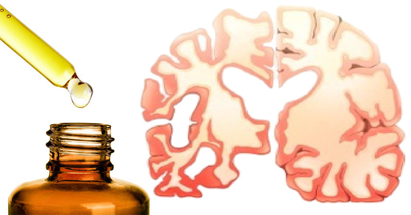 essential oil dementia FI