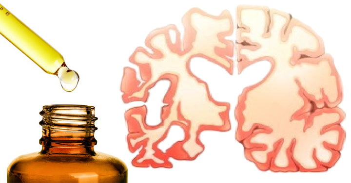 essential oil dementia FI