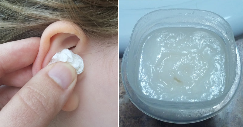 essential oil ear FI