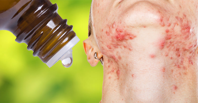 essential oil hormones FI
