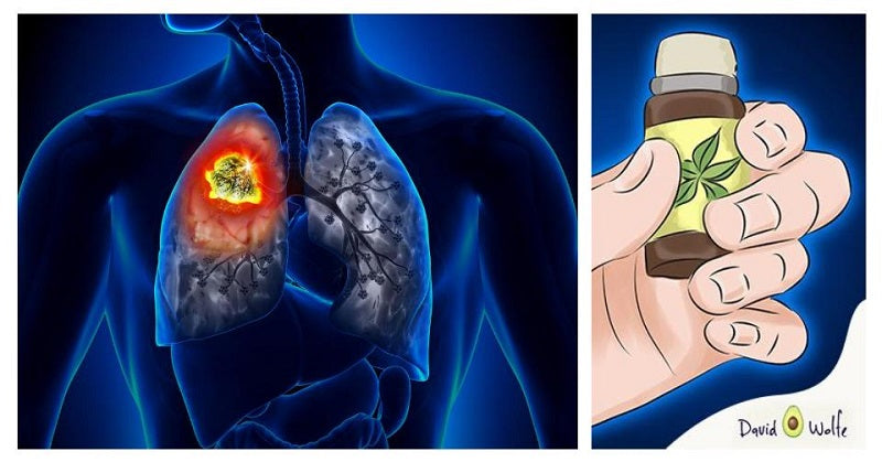 essential oils cancer