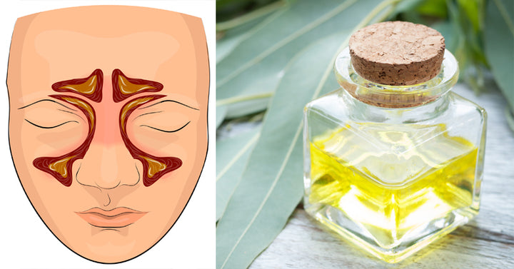 eucalyptus oil FI