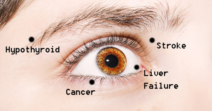eye health FI