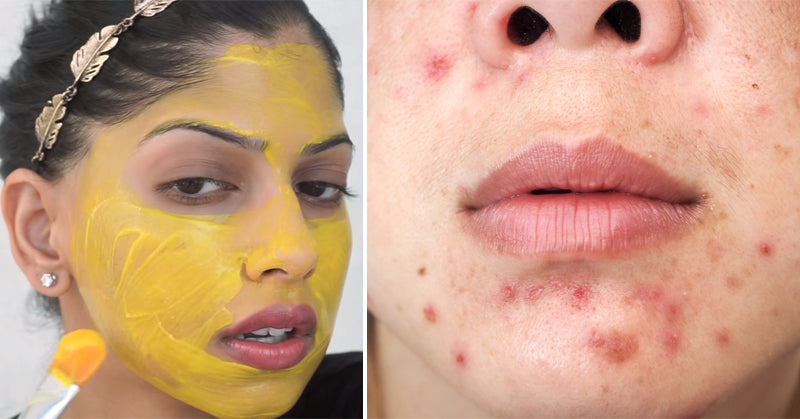 facial masks FI
