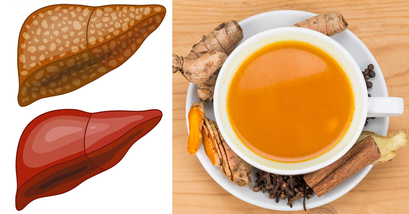 fatty liver detox FI