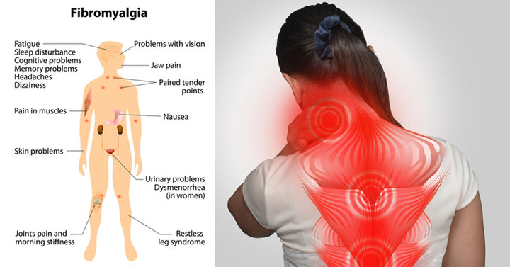 fibromyalgia pain FI