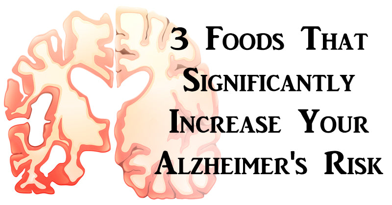 food alz risk FI