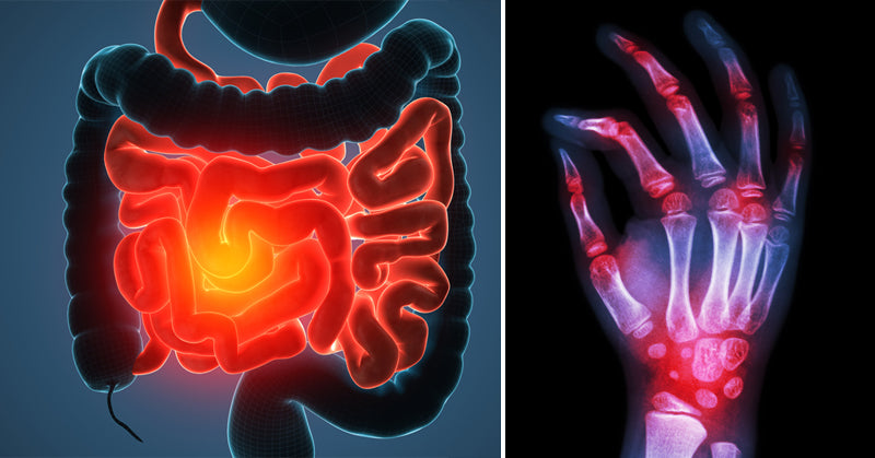 foods trigger autoimmune disease FI