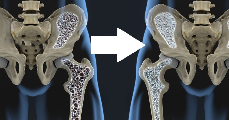 food osteoporosis FI
