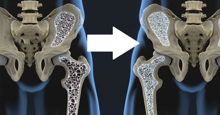 food osteoporosis FI