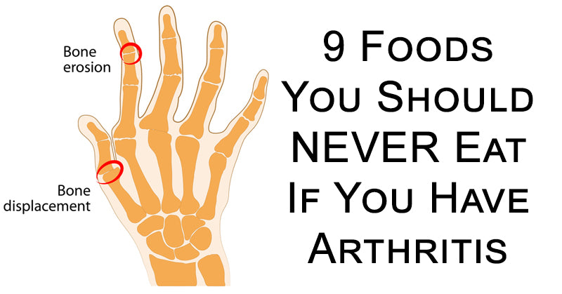 foods arthritis FI