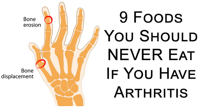 foods arthritis FI