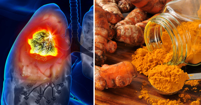 foods cancer fighters FI