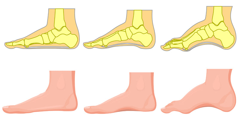 foot pain reasons FI02
