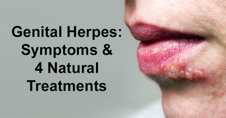 Genital Herpes: Symptoms & 4 Natural Treatments