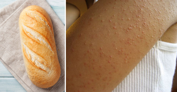 gluten sensitivity FI