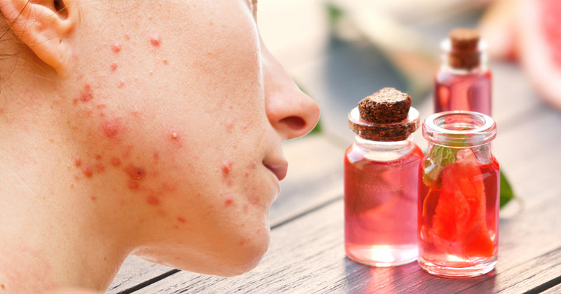 grapefruit essential oil FI