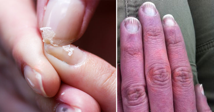 hand-health-fi