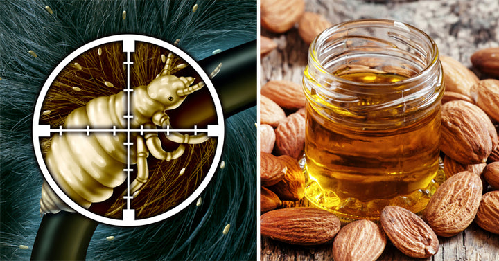 head lice remedies FI