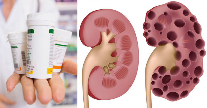 heartburn medication kidney disease FI