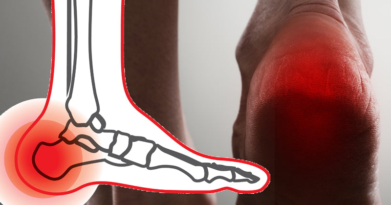 heel pain FI