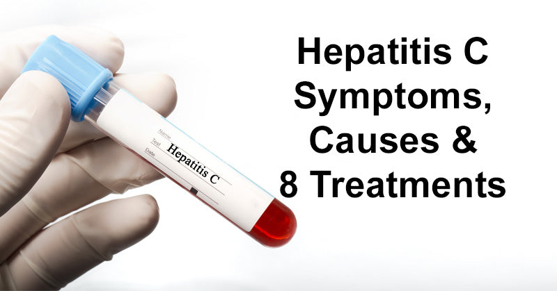 Hepatitis C Symptoms, Causes & 8 Treatments