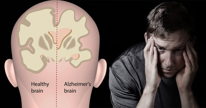 herbs Alzheimer's Disease FI