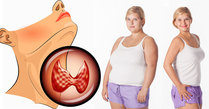 underactive thyroid weight loss FI