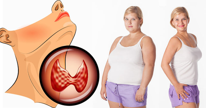 underactive thyroid weight loss FI
