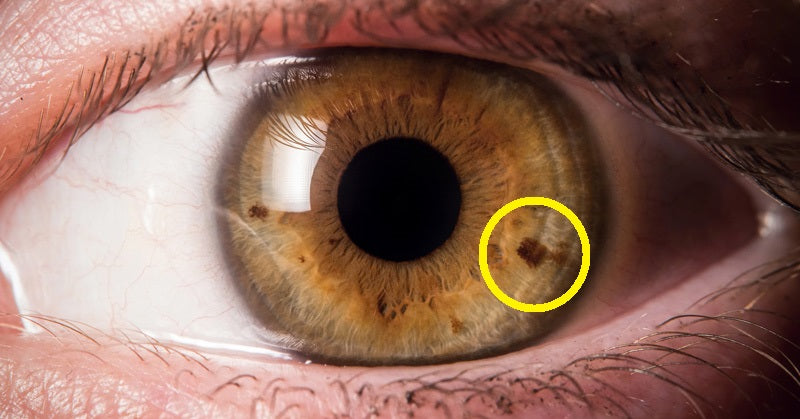 iris spot FI