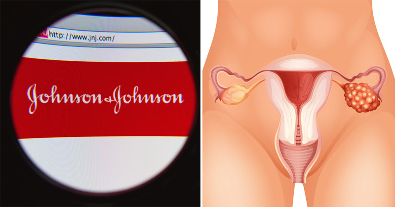 johnson ovarian cancer FI