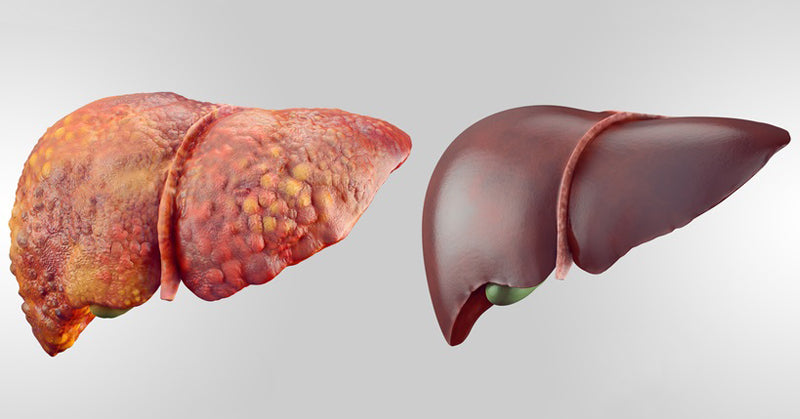 natural liver cleanse FI