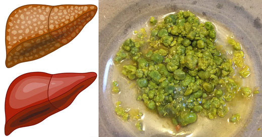 liver-gallbladder-flush-fi